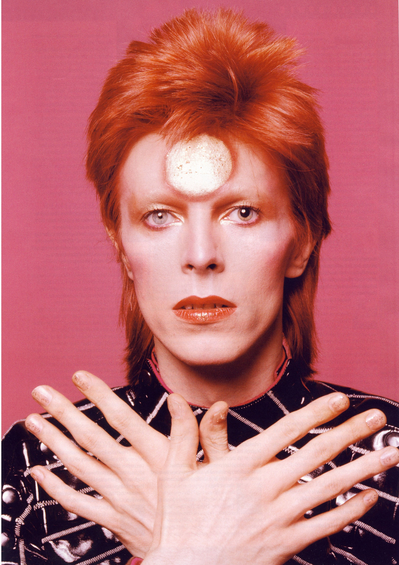 Os olhos de cores diferentes de David Bowie, como Ziggy Star Dust