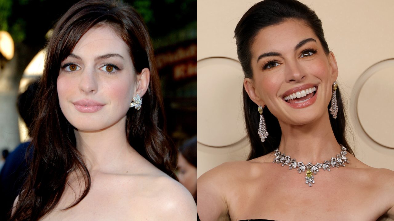 O truque de beleza de Anne Hathaway: Atriz revela segredo para rejuvenescer o rosto
